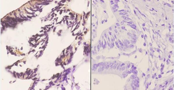 a01992 1 eif2ak3 primary antiboties ihc testing 2