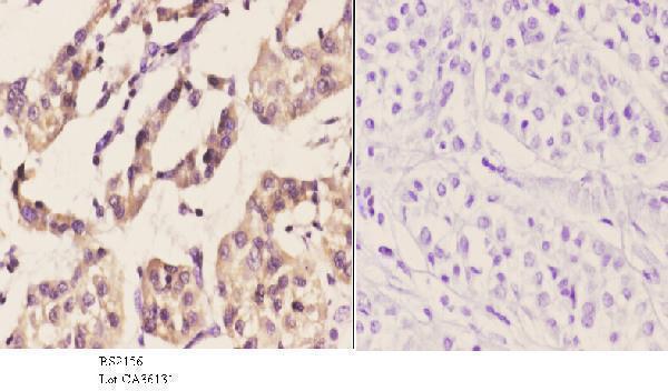 a01992 1 eif2ak3 primary antiboties ihc testing 3