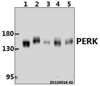 a01992 1 eif2ak3 primary antiboties wb testing 1