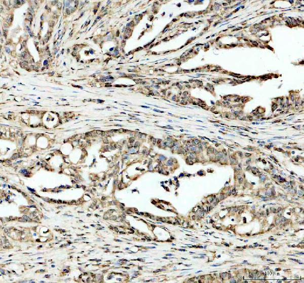 a01992 2 eif2ak3 primary antibodies ihc testing 1