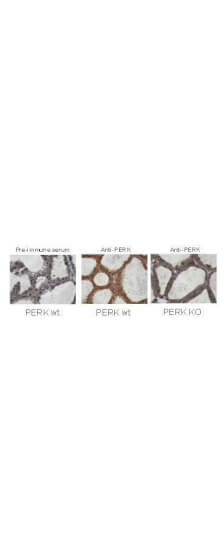 Immunohistochemistry staining of mouse mammary gland samples from lactating mice (L10) with Boster Immunochemical’s anti-PERK
