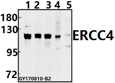 a01993 1 ercc4 primary antiboties wb testing 1