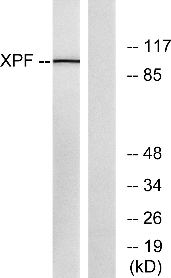 Western blot analysis of lysates from 293 cells, using XPF Antibody