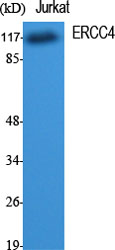 Western Blot analysis of various cells using ERCC4 Polyclonal Antibody cells nucleus extracted by Minute TM Cytoplasmic and Nuclear Fractionation kit 