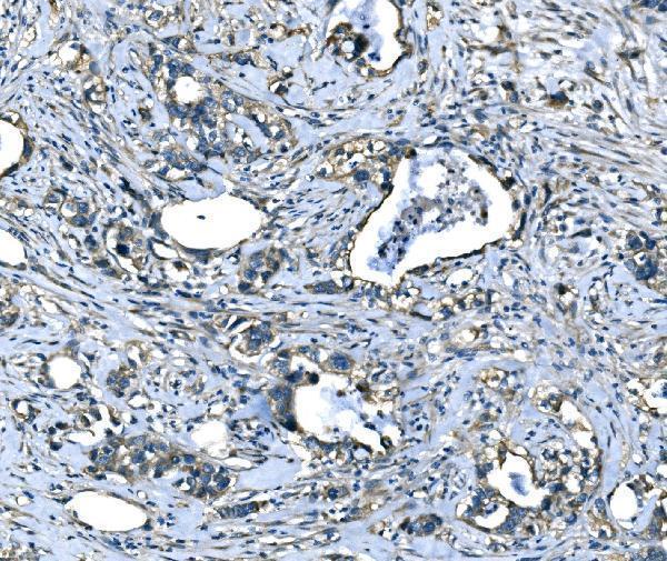  IHC analysis of SPG3A/ATL1 using anti-SPG3A/ATL1 antibody (A01994-1)