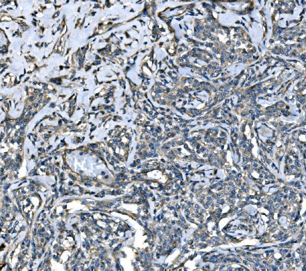 a01994 1 atl1 primary antibodies ihc testing 4