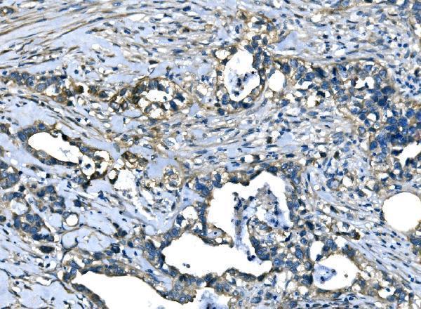 a01994 1 atl1 primary antibodies ihc testing 5