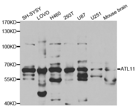 Western blot analysis of ATL1 polyclonal antibody