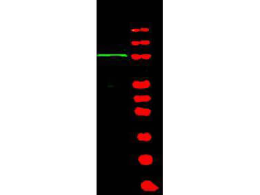 Western blot using Boster's Affinity Purified anti-BACH1 antibody shows detection of a band at ~105 kDa (lane 1) corresponding to human BACH1 present in a 293 whole cell lysate 