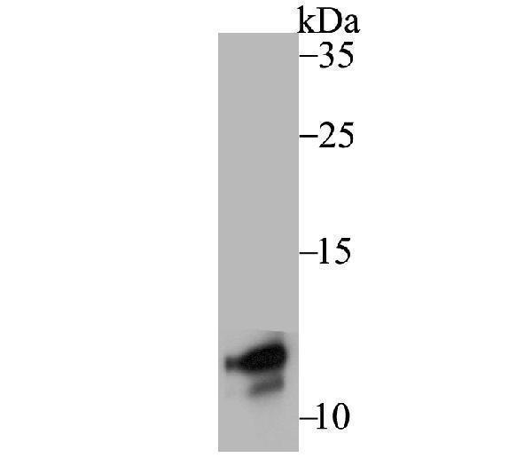 Western blot analysis of DAP12 on THP-1 cell using anti-DAP12 antibody at 1/500 dilution