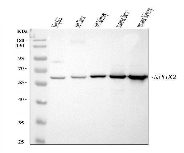  Western blot analysis of EPHX2 using anti-EPHX2 antibody (A01999-1)