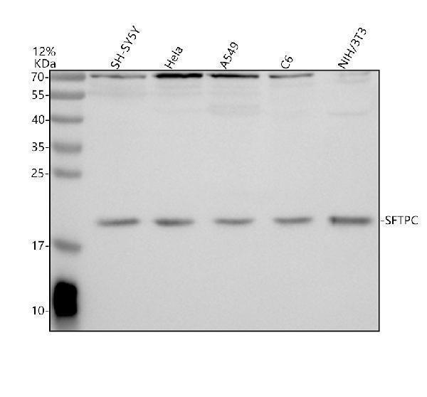 Western blot analysis of SFTPC using anti-SFTPC antibody (A02001-1)
