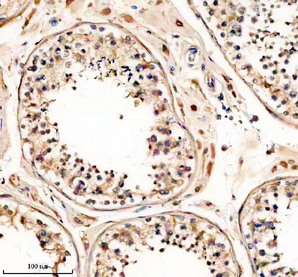 IHC analysis of PTGDS using anti-PTGDS antibody (A02003-2)