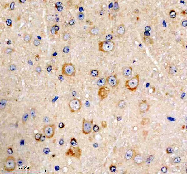 a02003 2 ptgds primary antibodies ihc testing 2