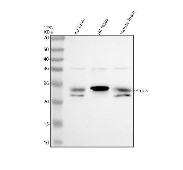 Western blot analysis of PTGDS using anti-PTGDS antibody (A02003-2)