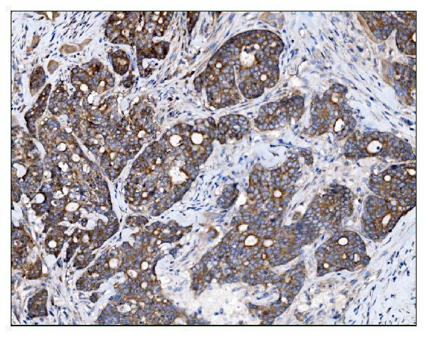 a02004 3 tbc1d4 primary antibodies ihc testing 2