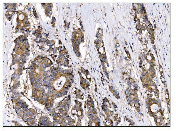a02004 3 tbc1d4 primary antibodies ihc testing 3