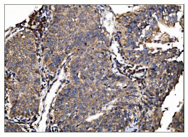 a02004 3 tbc1d4 primary antibodies ihc testing 4