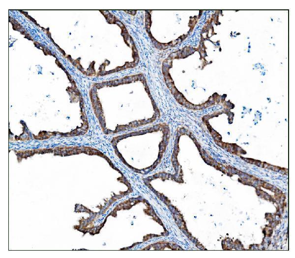 a02004 3 tbc1d4 primary antibodies ihc testing 5