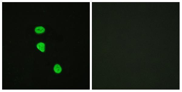 a02004t642 1 tbc1d4 primary antibodies if testing 1