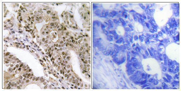 a02004t642 1 tbc1d4 primary antibodies ihc testing 3