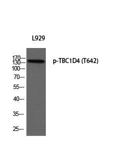 a02004t642 1 tbc1d4 primary antibodies wb testing 2