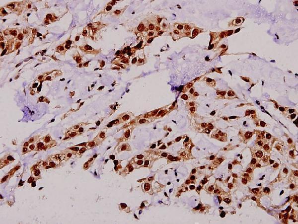 a02004t642 tbc1d4 primary antiboties ihc testing 2