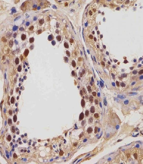a02007 1 anti igf2bp1 antibody c term ihc p testing 2