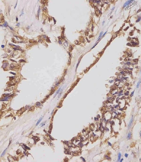 a02007 1 anti igf2bp1 antibody c term ihc p testing 3