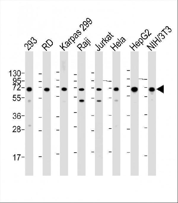 a02007 1 anti igf2bp1 antibody c term wb testing 1