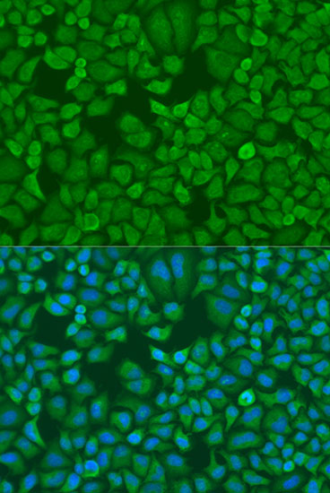 a02007 igf2bp1 primary antiboties if testing 3