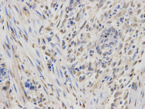 a02007 igf2bp1 primary antiboties ihc testing 2