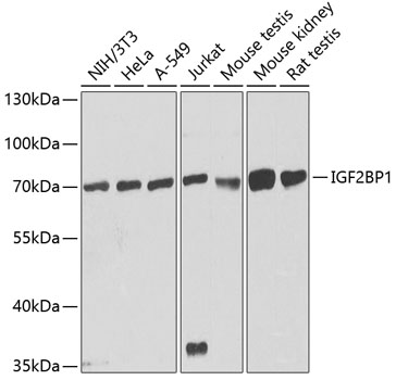 a02007 igf2bp1 primary antiboties wb testing 1