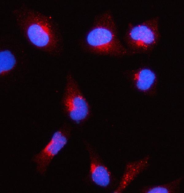 a02008 1 acat1 primary antibodies if testing 5