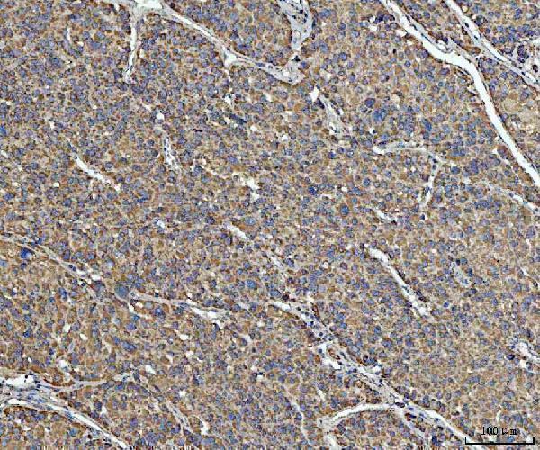 a02008 1 acat1 primary antibodies ihc testing 2