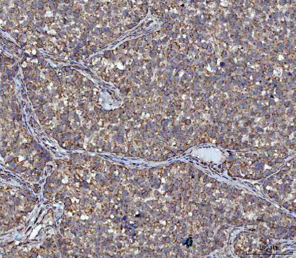 a02008 1 acat1 primary antibodies ihc testing 3