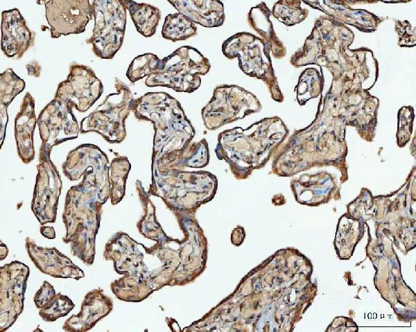 a02008 1 acat1 primary antibodies ihc testing 4