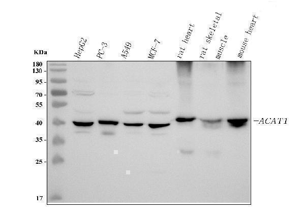 a02008 1 acat1 primary antibodies wb testing 1
