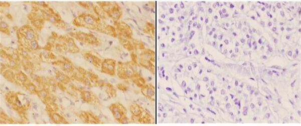 a02008 acat1 primary antiboties ihc testing 2