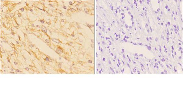 a02008 acat1 primary antiboties ihc testing 3