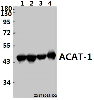 a02008 acat1 primary antiboties wb testing 1