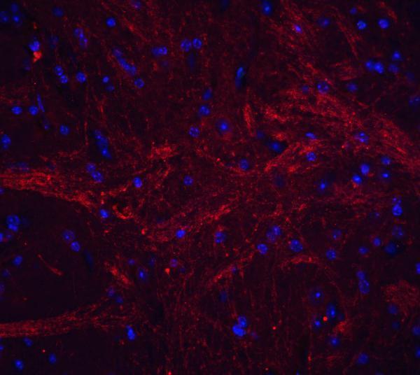 a02009 2 tnfsf12 primary antibodies if testing 7