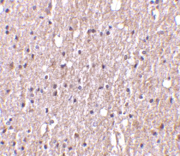 a02009 2 tnfsf12 primary antibodies ihc testing 5
