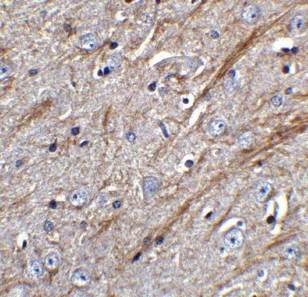 a02009 2 tnfsf12 primary antibodies ihc testing 6