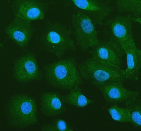 a02010 4 igf2bp2 primary antibodies if testing 1