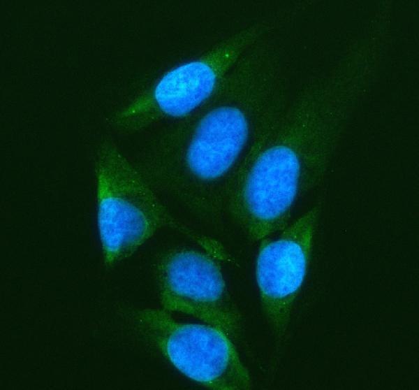 a02010 4 igf2bp2 primary antibodies if testing 10