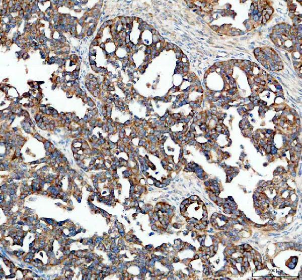 a02010 4 igf2bp2 primary antibodies ihc testing 1