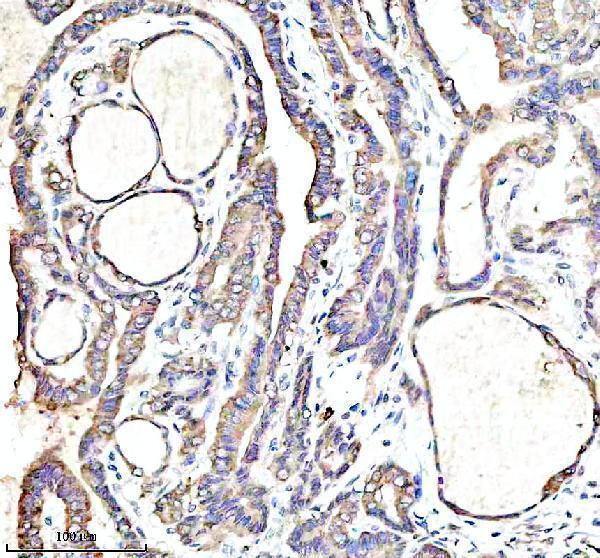  IHC analysis of IGF2BP2 using anti-IGF2BP2 antibody (A02010-4)