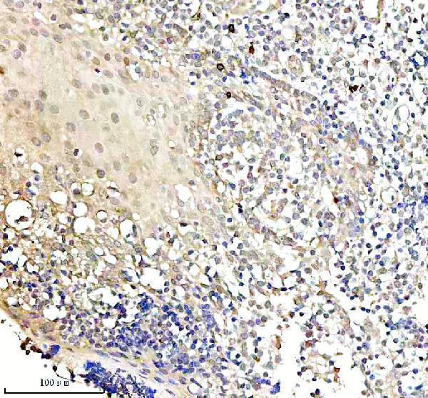  IHC analysis of IGF2BP2 using anti-IGF2BP2 antibody (A02010-4)