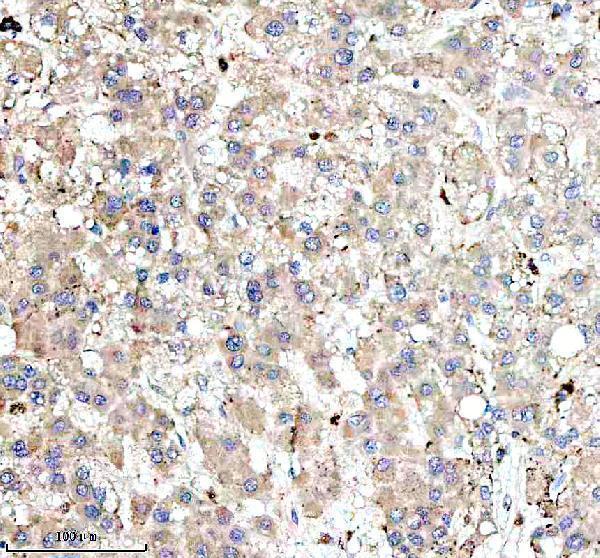 a02010 4 igf2bp2 primary antibodies ihc testing 4